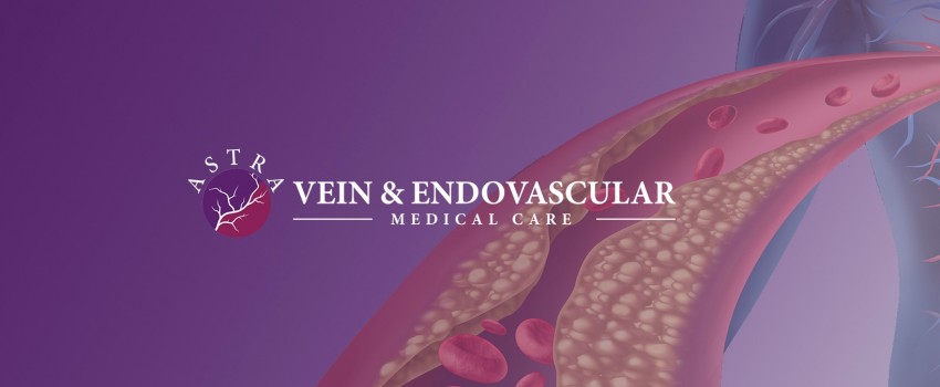 Astra Vein Treatment Center