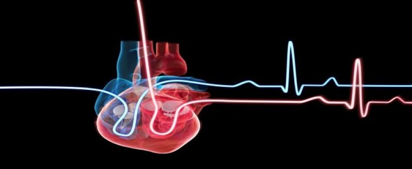 Cardiac Rhythm Device 2022 CNE Conference, Rochester, MN (Oct 2022 ...