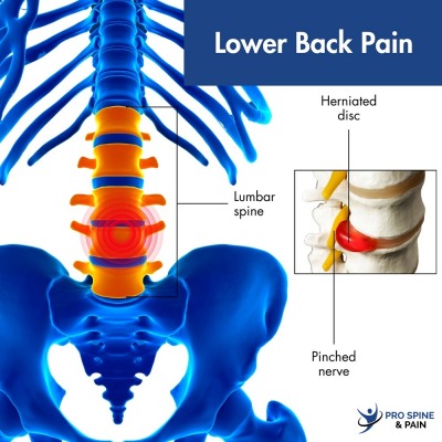  Advantages of Services in Pro Spine & Pain