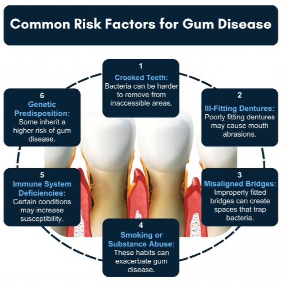 Gum Grafting recovery in Queens, NY , Precision Dental NYC