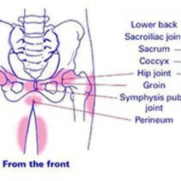 Pelvic Pain