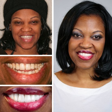 Cosmetic Dentistry in Brooklyn NYC