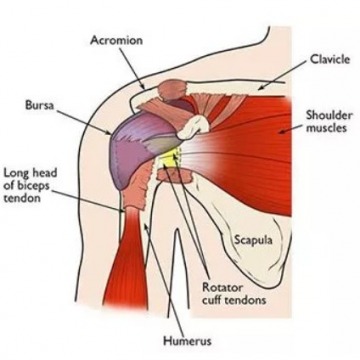 Shoulder Pain Doctor in New Jersey