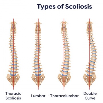 SCOLIOSIS DOCTORS IN NEW JERSEY