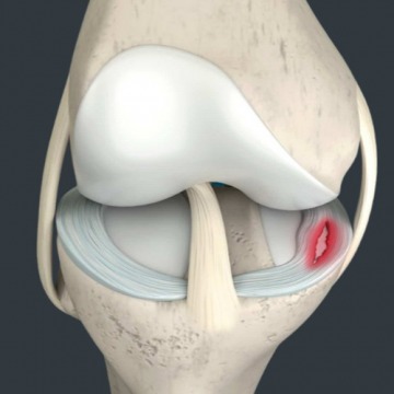 Knee Pain Specialists NJ